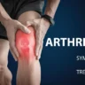 Arthritis Treatment