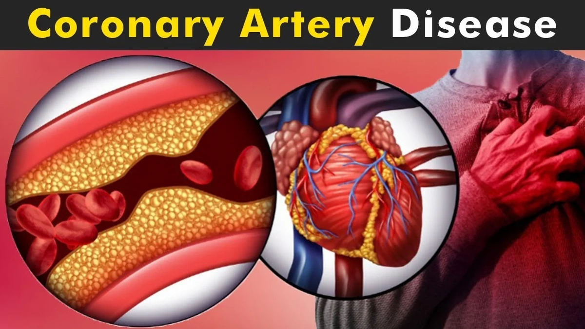 Heart disease