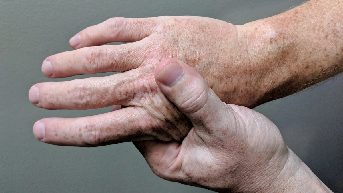Arthritis Day 2025 | 7 Early Warning Signs You Can't Ignore 2 1. Persistent Joint Pain | More Than Just a Little Ache