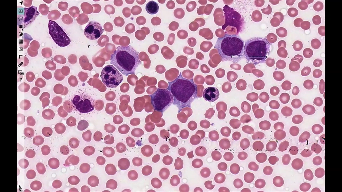The "Why" | Decoding Disease at the Protein Level