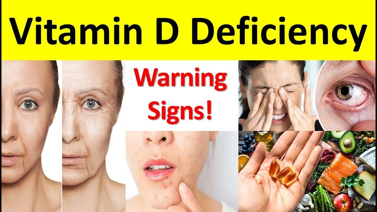 vitamin deficiency